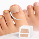 Adesivo para Unhas | Fungos e Unhas Encravadas | 32 Un