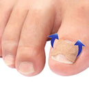 Adesivo para Unhas | Fungos e Unhas Encravadas | 32 Un